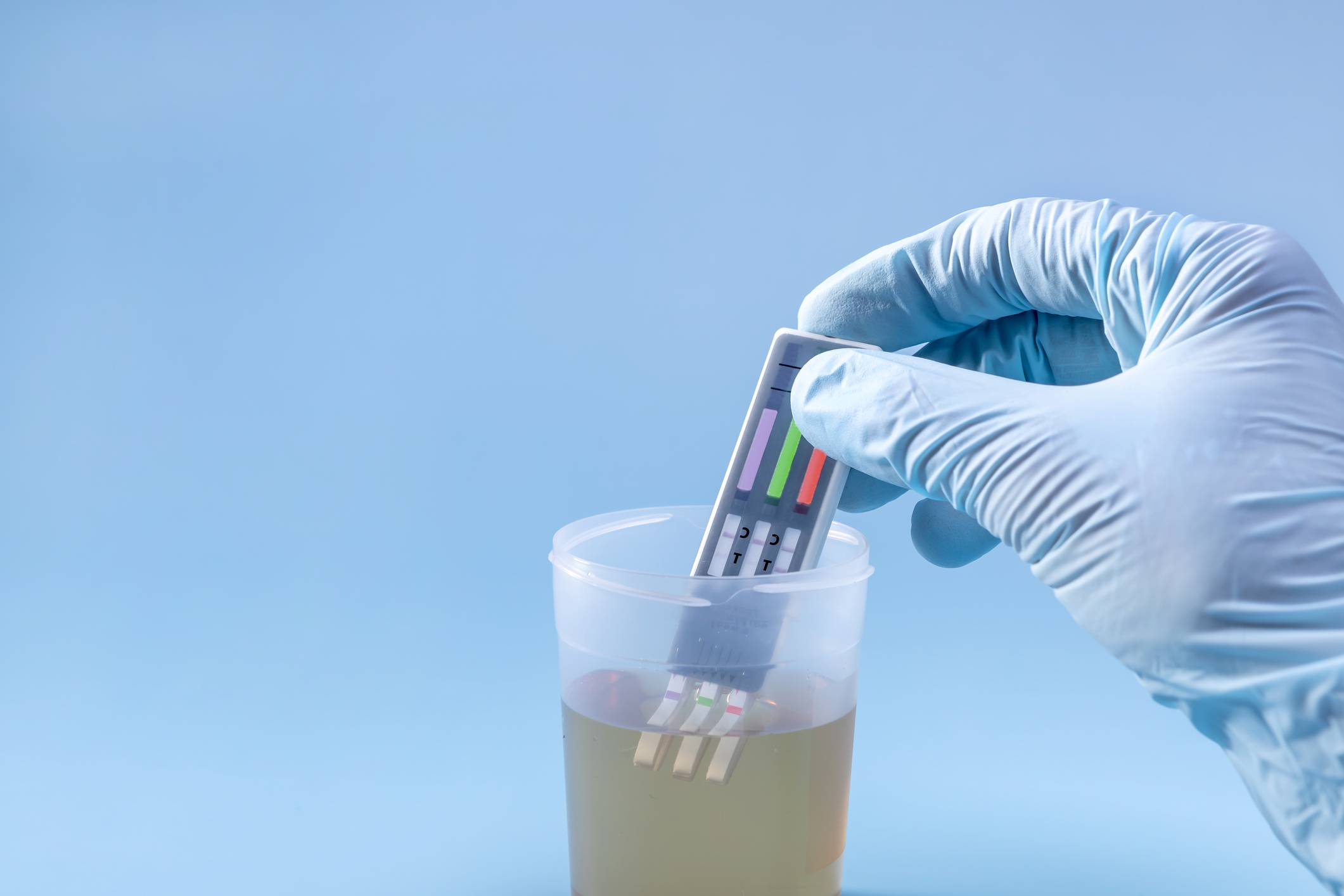 Drug and Alcohol Testing